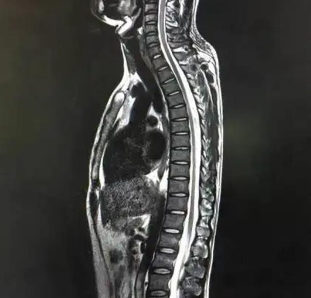 核磁共振成像MRI